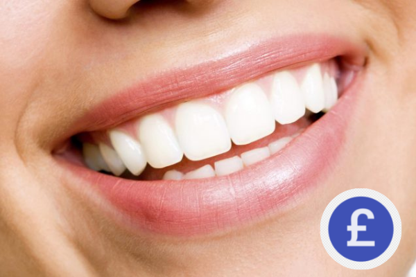 Teeth Whitening Cost in UK